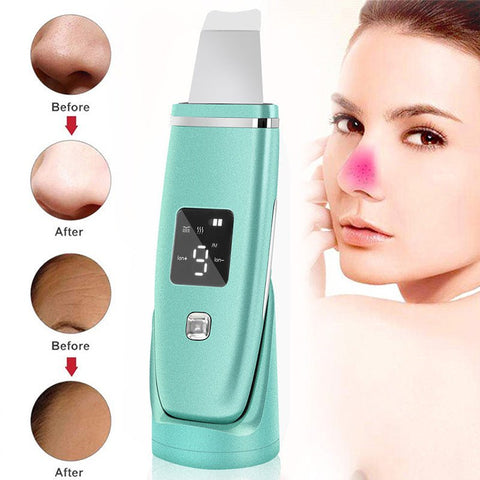 Ultrasonic Skin Scrubber & Facial Pore Cleaner